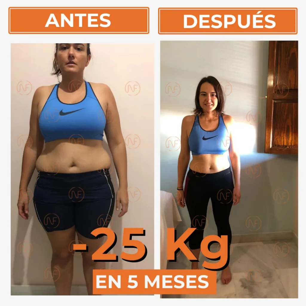 A_D Ana Álvarez Frontal