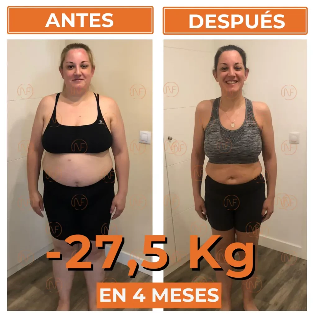 A_D Ana Ferrant Frontal