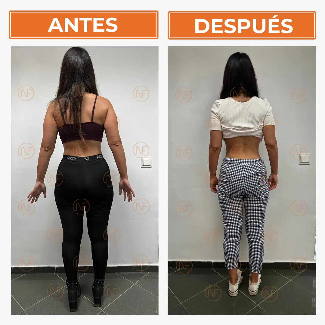 A_D Lorena Espaldas