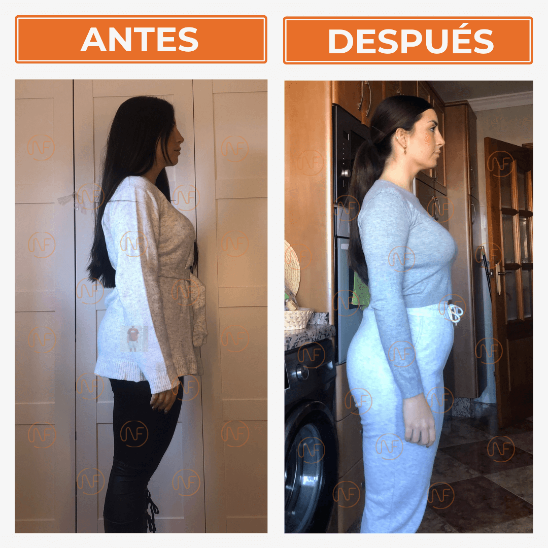 Andrea-perdida-de-peso-saludable-anttes-despues-perfil resultado nutrición personalizada pérdida de grasa